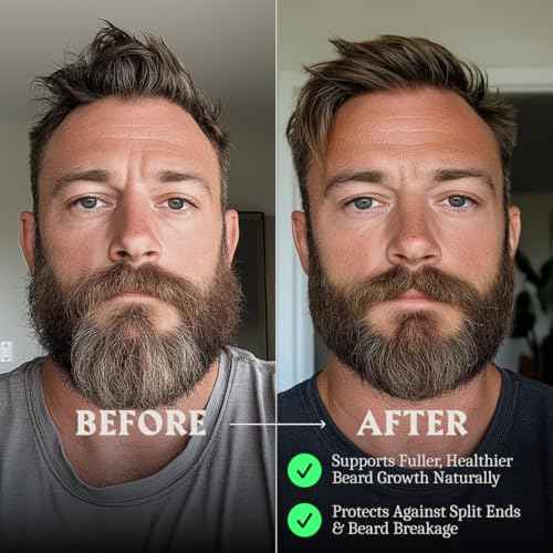 Striking Viking Beard Balm & Beard Oil for Men ? Unscented, 1 Fl Oz Each - Dual-Use Leave In Conditioner - Tames, Styles & Moisturizes ? With Naturally-Derived Argan & Jojoba Oil