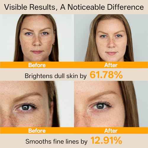 WNP Vitamin C Serum for Face - Dermatologist Tested Anti-Aging & Brightening with Hyaluronic Acid & Vitamin E, Treatment for Dark, Age, Sun Spot, Melasma, Hyperpigmentation, Fine Lines & Wrinkles