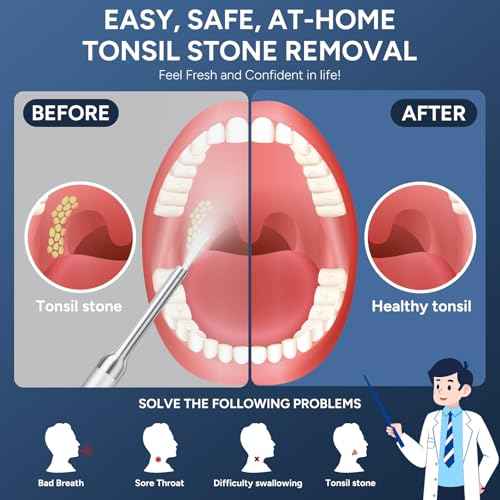 Tonsil Stone Remover with Camera - Upgraded Visual Tonsil Stone Removal Kit with 6 LED Light -Tonsil Stone Remover Tool with 1080P Camera, 5 Stainless Steel Heads, Irrigator, for iOS & Android(White)