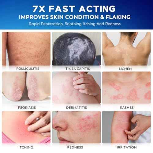 Folliculitis Treatment Cream, 7X Fast-Acting Antibacterial Ointment for Scalp, Face & Body, Relieves Itching, Redness & Bumps, Intensive Skin Therapy ? 120g