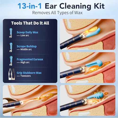 Ear Wax Removal, Ear Cleaner with Camera with Ear Scope, Ear Wax Removal Kit with Camera,Ear Cleaning Tool