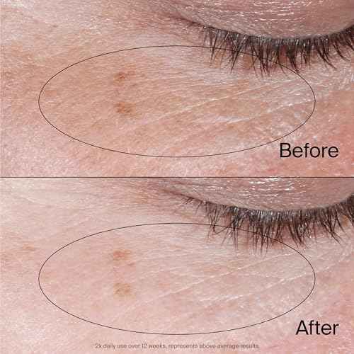 Neutrogena Collagen Bank Reviving Eye Cream, Under Eye Cream, Helps Preserve Collagen, Visibly Improves Dark Circles, Puffiness, Fine Lines, Texture, Fragrance Free, with Peptides 0.5 oz