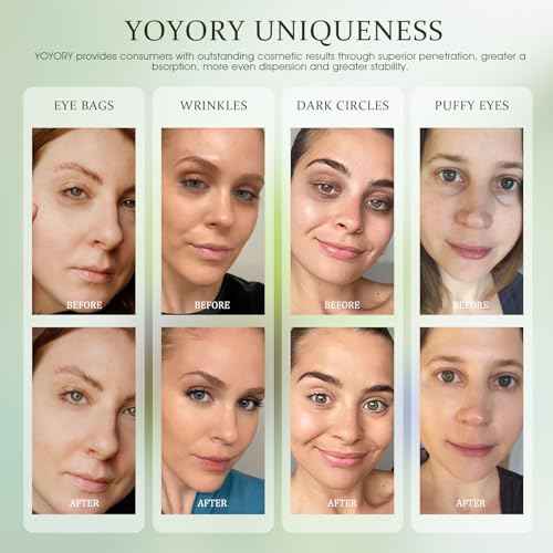 Under Eye Patches Masks - for Eye Bags with Collagen and Hyaluronic Acid, Dark Circles,and Fine Lines, Fade Wrinkles Treatment for Women and Men - 60 Pcs Green