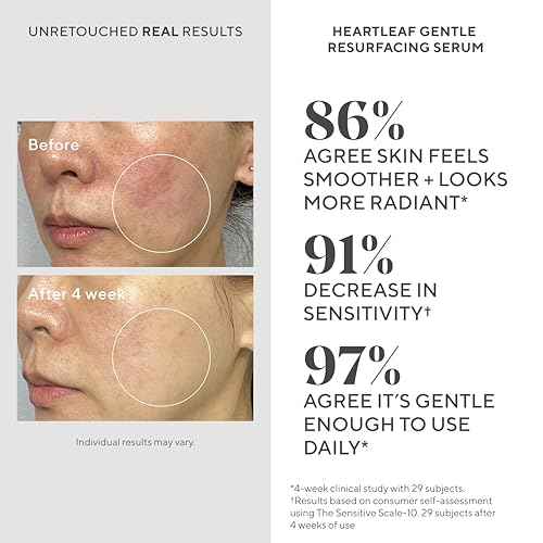 Murad Heartleaf Gentle Resurfacing Serum ? Low-Dose Glycolic Acid, AHA and Heartleaf Comfortably Exfoliates Senstive Skin to Improve Radiance and Smooth Fine Lines & Wrinkles ? 1.0 Fl Oz