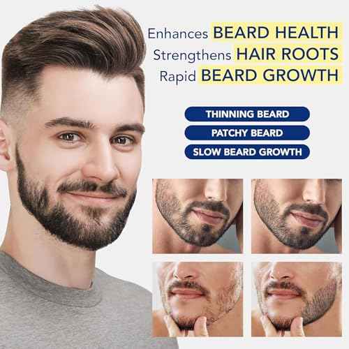 5% Minoxidil for Men & Women, Hair Beard Growth Spray with Biotin, Minoxidil Hair Growth Serum for Hair Regrowth, for Hair Loss & Thinning, make Hair Stronger Thicker -3.38 fl.oz /100ml