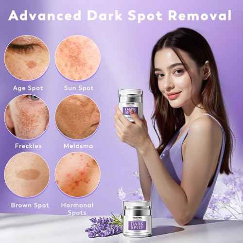 HANYWIL Dark Spot Remover for Face and Body, Remedy for Dark Spots with Natural Ingredients, Dark Spot Corrector Cream and Serum for Skin Care, Treats Freckles, Melasma, Sun Spots, for Women,1.7 Fl Oz