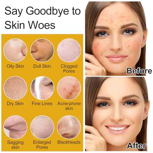 Skin Care Set,6Pcs Women Teen Glass Skincare w/Korean Rice Extract,Hydrate Glow Repair Anti-Aging Facial Routine Kit Gift for Women Mom Wife Teenage Girl Trendy Stuff Christmas Gifts Stocking Stuffers