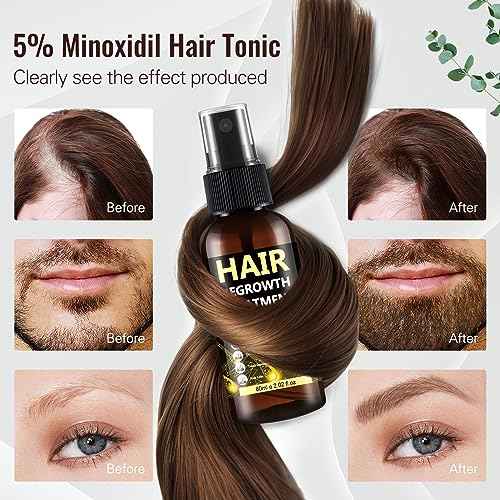 5% Minoxidil for Men & Women, Advanced Formula Hair Regrowth Spray and Topical Solution for Thinning Hair and Beard, Long-Lasting Results