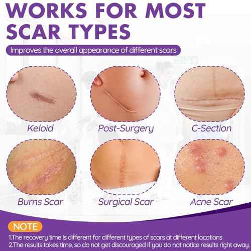 Silicone Scar Sheets, Silicone Scar Tape(1.6"x 118" Roll-3M), Reusable Professional Scar Silicone Strips, Soft Silicone Scar Sheets for Surgical Scars,Keloid,Acne Scars,Burn Scar,C-Section