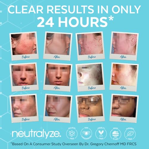 Neutralyze Moderate to Severe Acne Treatment Kit 2.0 - Maximum Strength 3 Step Acne Kit with 2% Salicylic Acid, 2% Mandelic Acid & Nitric Oxide - Includes Face Wash, Clearing Serum & Synergyzer
