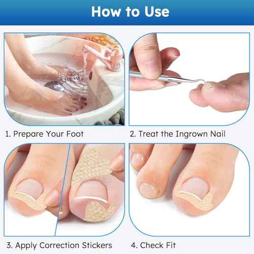 Ingrown Toenail Treatment, No Glue Breathable Curved Toenail Corrector£¬Ingrown Toenail Corrector Strips with File and Lifter, Professional Nail Correction Stickers 60Pcs