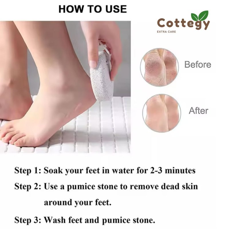 2-Pack Cottegy Natural Foot Pumice Stone for Feet, Pedicure Tools Hard Skin Callus Remover for Feet and Hands - Natural Foot File Exfoliation to Remove Dead Skin, Heels, Elbows, Hands. (White)