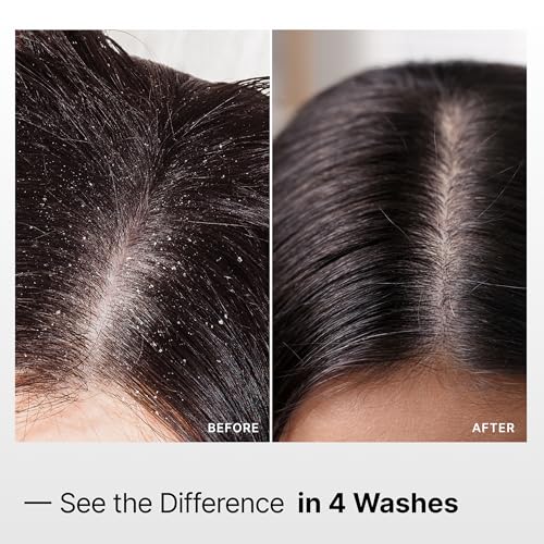 My Way Hair DNA Detox Shampoo ? Deep Clarifying Formula for Product Buildup, Scalp Health Balance, and Damage Repair ? Paraben, Phthalate, Sulfate, and Cruelty-Free Hair Care (8 oz)