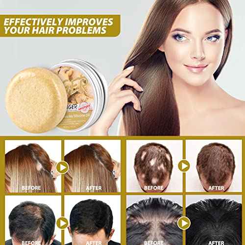 Natural Organic Ginger Hair Regrowth Shampoo Bar Soap for Anti Hair Loss, Dandruff, Itching - Promotes Hair Growth, All Hair Types (3 Pcs)