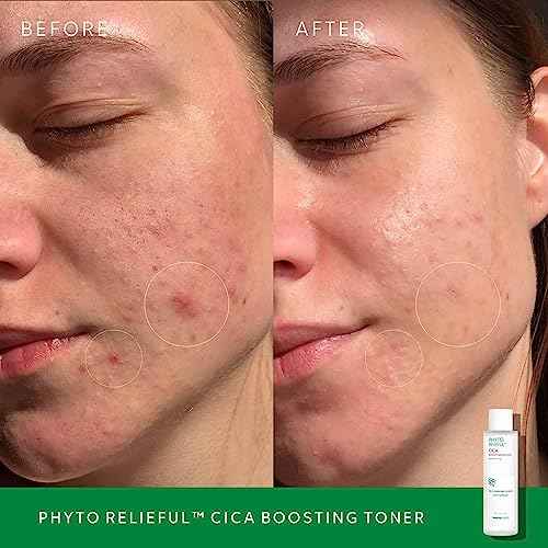 THANKYOU FARMER Phyto Relieful CICA PHA LHA Boosting Toner 7.03 fl oz (200ml), Dermatologist Tested, Alcohol-Free Liquid Exfoliant for Face, Oil-Free Hydrating Toner, Vegan, Fragrance-Free