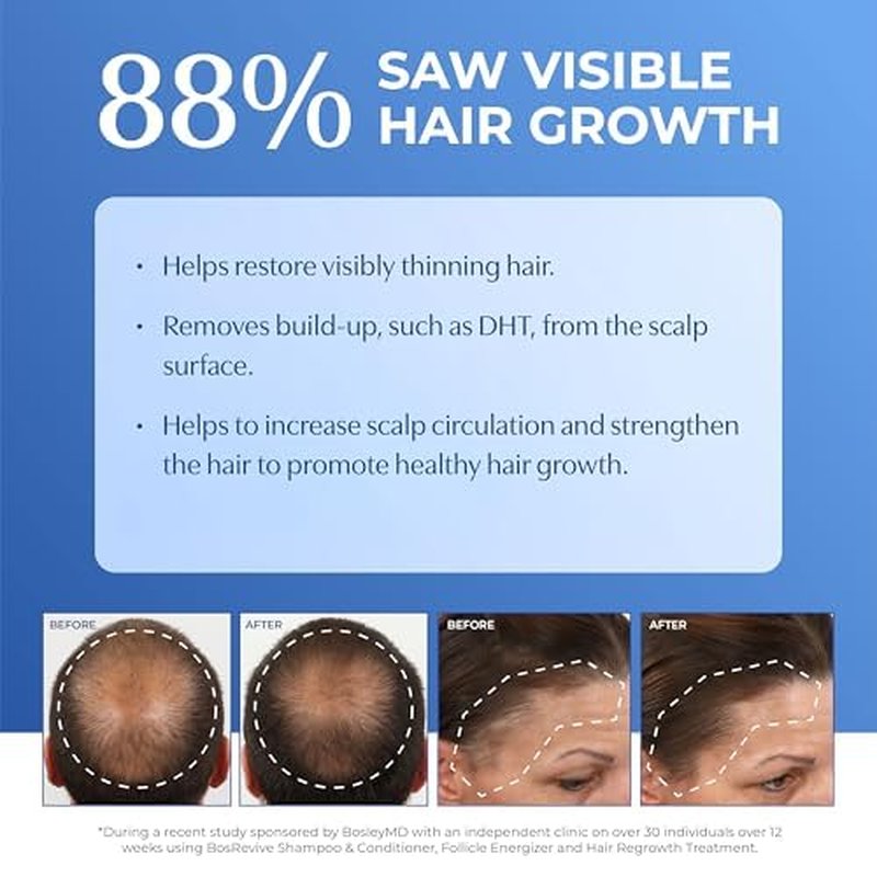 BosRevive Nourishing Shampoo - Restores Thinning Hair & Boosts Scalp Circulation | Sulfate-Free 10.1 Fl Oz