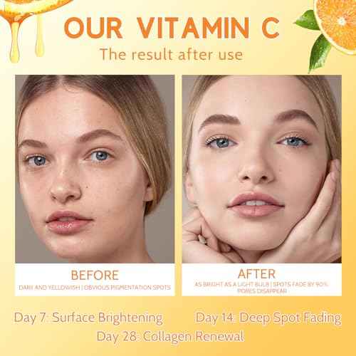 Premium 20% Vitamin C Serum for Face with Vitamin E, Sodium Hyaluronate - Boost Skin Collagen,Hydrate & Plump Skin, Anti Aging & Wrinkle Facial Serum (1 Fl Oz, Scented)