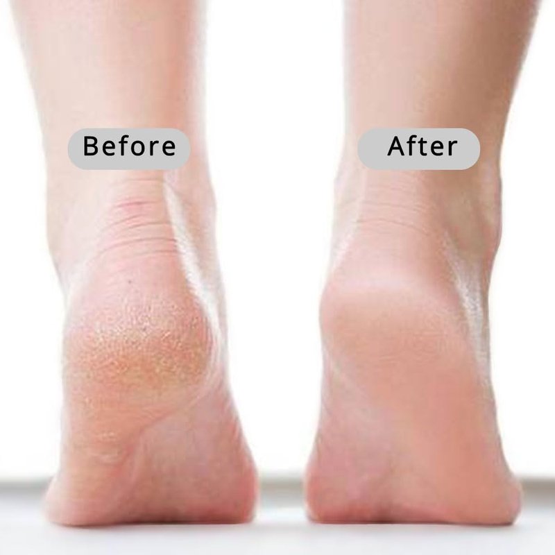 CopesFuda Curved Handle -13.7" Pumice Stone - Ergonomic Non-Slip Foot Scrubber for Shower - Easy Reach Callus Remover & Pedicure Tool for Cracked Heels & Smooth Feet