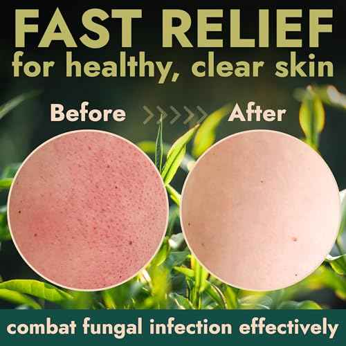 Terramed Just Think Comfort Antifungal Body Scrub with Tea Tree Oil ? Exfoliating Body Wash for Women & Men ? Soothes Itchy Skin, Rashes, Acne, Warts & Insects Bites ? 12 Fl oz with Scrubber Brush