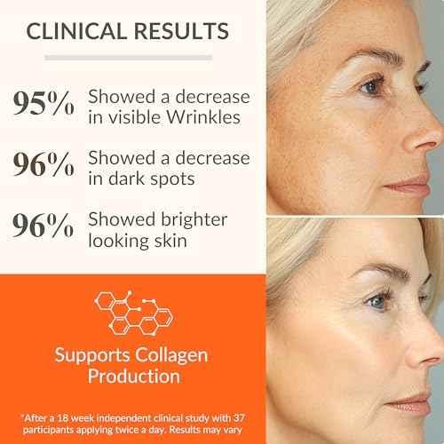 LeVaye Vitamin C Serum, Anti-Aging Face Serum ? 15% Vitamin C, Ferulic Acid, Niacinamide, Hyaluronic Acid, Peptides, Ceramides ? Targets Wrinkles, Fine Lines, Dark Spots, Enlarged Pores, Dry Skin