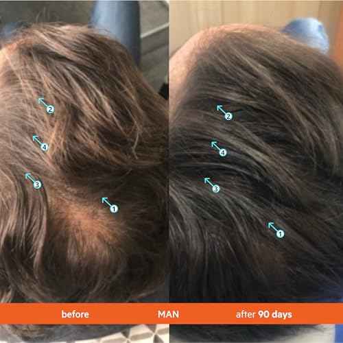 DS Labs Revita Conditioner, 500 mL ? Scalp Refreshing Hydration for Fuller Looking, Weightless Hydration, Caffeine, Turmeric, Sulfate & Silicone Free, Color Safe, For Men & Women