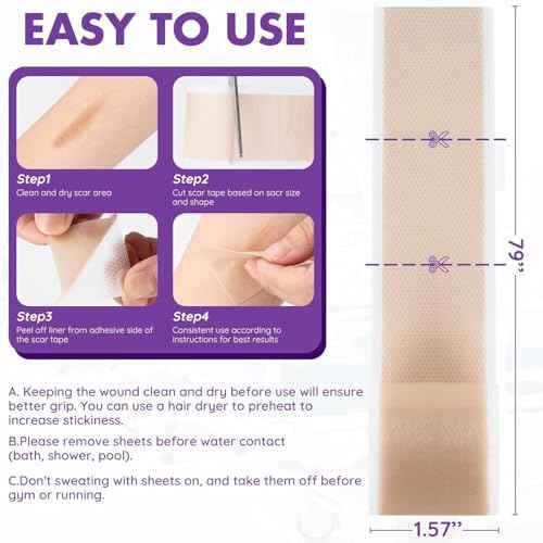 Silicone Scar Sheets, Silicone Scar Tape(1.6"x 118" Roll-3M), Reusable Professional Scar Silicone Strips, Soft Silicone Scar Sheets for Surgical Scars,Keloid,Acne Scars,Burn Scar,C-Section