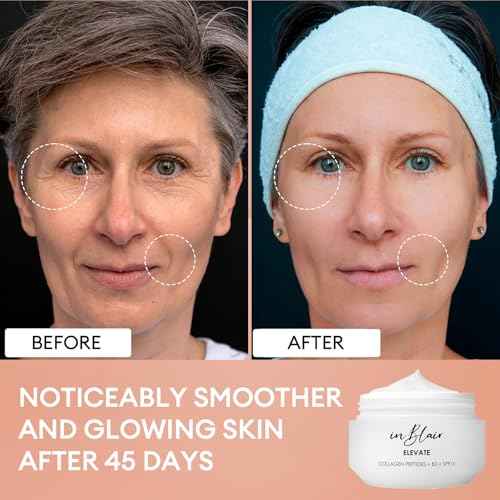 Elevate Moisturizing Cream for Face | Facial Care for Dry Skin with SPF | Hydrating Moisturizer Rich in Niacinamide, Hyaluronic Acid & Collagen Peptide | Anti Aging Day & Night Cream