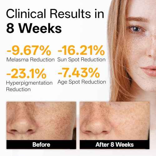 WNP Vitamin C Serum for Face - Dermatologist Tested Anti-Aging & Brightening with Hyaluronic Acid & Vitamin E, Treatment for Dark, Age, Sun Spot, Melasma, Hyperpigmentation, Fine Lines & Wrinkles