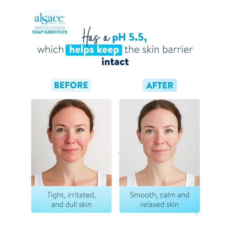 EPIDERMIQUE Alsace Soap Free Face Wash | Gentle Cleansing Foam for Sensitive Skin | pH 5.5 Facial Cleanser with Aloe Vera & Calendula | Hydrating Face Wash for Women & Men - 6.7 fl oz