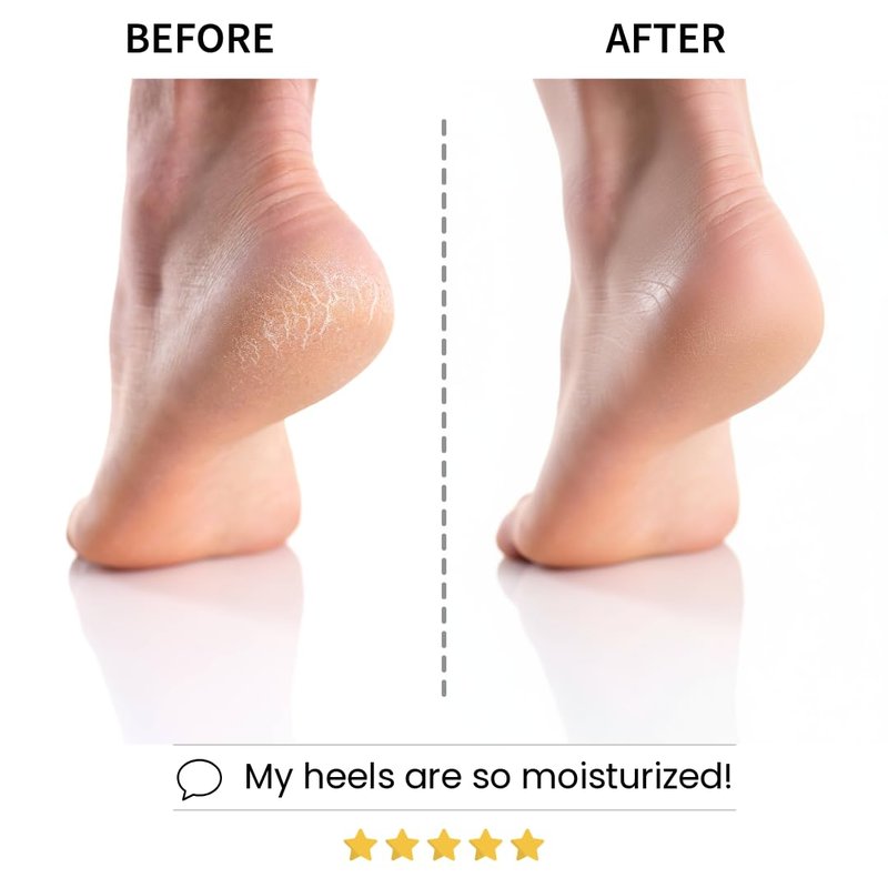 Codi New York Relaxing Aroma Foot Mask, Home Spa Moisturizing Pedicure Socks, 6 Pairs, For Dry Cracked Heel, Hydrating Foot Treatment, Made in Korea (Lavender)