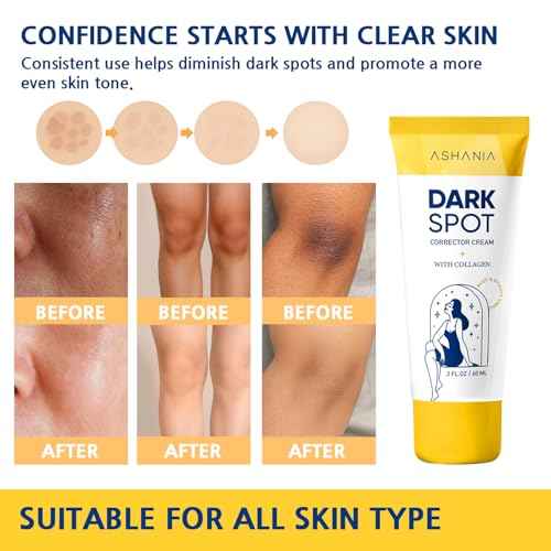 Dark Spot Remover for Face and Body: Advanced Corrector Formula for Inner Thighs, Dark Neck & Knees ? Advanced Formula (2 Fl Oz)