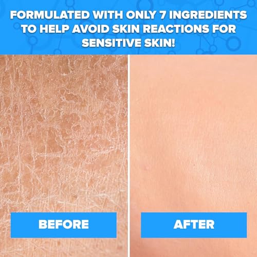 Aquanil Cleanser 16 oz (Pack of 4)