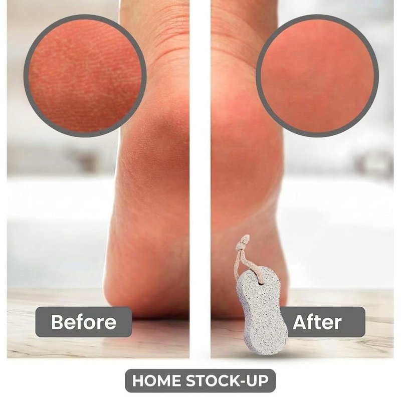 Pumice Stone Pack of 2 Natural Volcanic Stones for Gentle Exfoliation, Callus and Dead Skin Removal, Safe for Feet and Hands