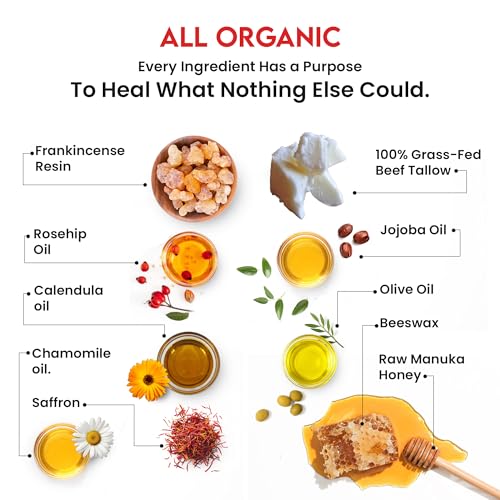 Whipped Tallow Honey Balm ? Grass-Fed Beef Tallow infused with Organic Manuka Honey, Rosehip, Jojoba & Olive Oils ? Nourishing Face, Neck & Body Lotion, 100% Organic (Frankincense Scent - 2 oz)