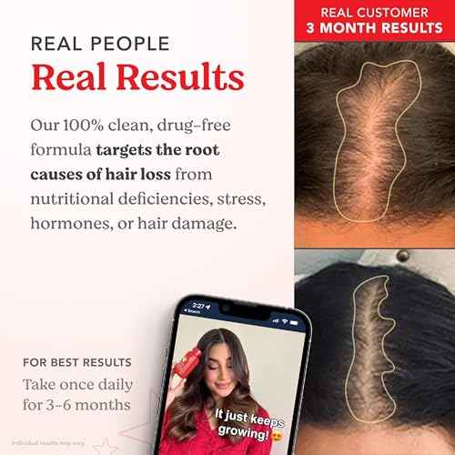 HAIRtamin Advanced Formula Hair Growth Supplement for Women & Men, Supports Stronger, Longer, Visibly Thicker Hair, With 5000 mcg Biotin, Vitamins & Antioxidants, 100% Vegan ? 3 Month Supply