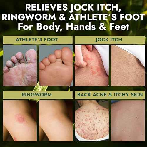 Antifungal Soap | Deep-Cleansing & Exfoliating Bar for Men & Women | Natural Ingredients with Tea Tree & Eucalyptus | Helps Soothe Jock Itch, Ringworm & Athlete¡¯s Foot Pumice Bar Soap
