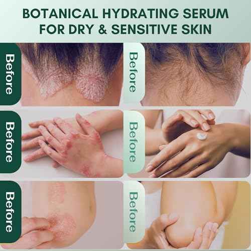 ABERA Alan Silver Serum ? Botanical Hydrating Serum for Dry & Sensitive Skin & Herbal Extracts ? Daily Moisturizer for Face, Body & Scalp ? Fast Absorbing, Lightweight ? (2 boxes)