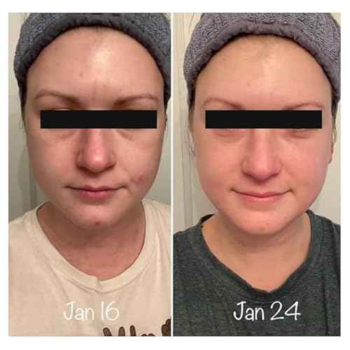 Intoxicated Cosmetics Snail Serum - Luxurious Anti-Aging Skin Care with XEP-018 and Hyaluronic Acid for Extreme Lifting, Hydration and Regeneration