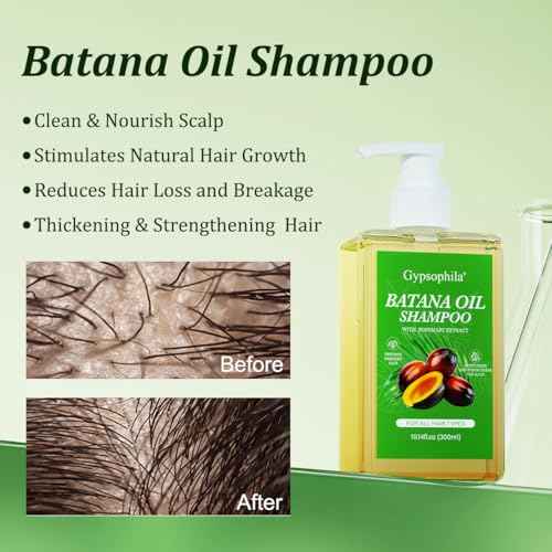 Batana Oil Shampoo for hair growth, Rosemary Shampoo,Nourishing & Rejuvenating for Softness & Volume, Suitable for Men & Women, Reduces Hair Loss (10.14 fl oz)