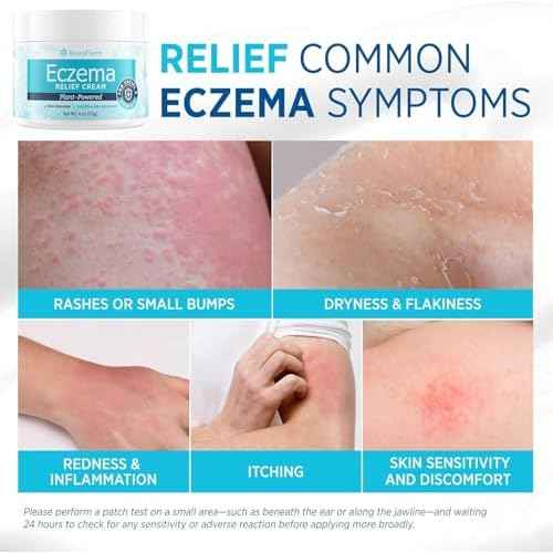 Roycederm Eczema & Psoriasis Cream for Dry, Itchy Skin ? Moisturizer for Sensitive Skin, Eczema, Psoriasis & Dermatitis ? 1% Colloidal Oatmeal + Ceramides ? Steroid-Free for Adults, Kids & Babies