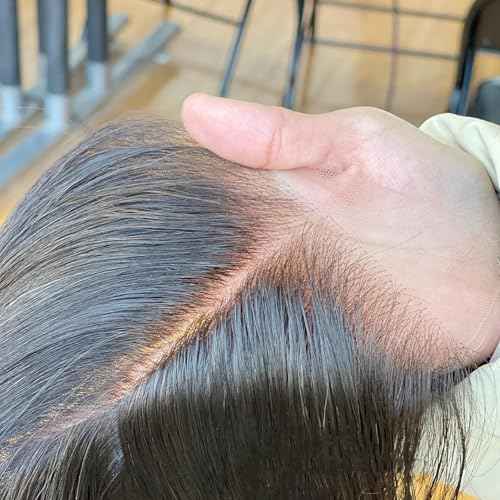 SKINLIKE Real HD Swiss Lace Closure Human Hair 5x5 Lace Closure with Clean Hairline Much More Density Full Cuticle Aligned Brazilian Human Hair Body Wave Style (18inch, HD BW 5x5 lace clsoure)