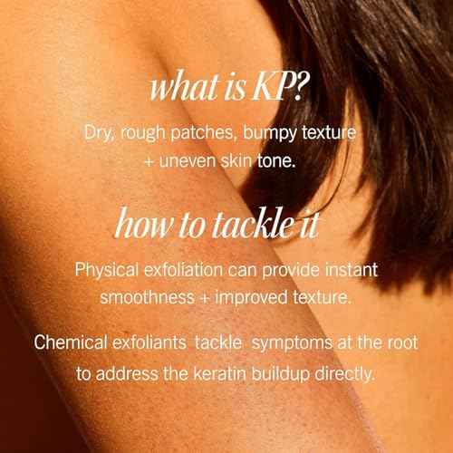 First Aid Beauty - KP Bump Eraser Body Scrub with 10% AHA, Keratosis Pilaris Exfoliator with Glycolic and Lactic acids, Helps Reduce Chicken Skin Bumps, Safe for Sensitive Skin, Strawberry Scent, 8 oz