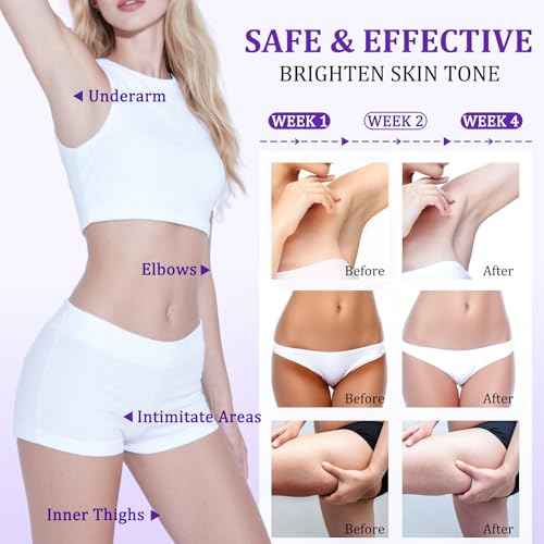 Dark Spot Remover for Body, Skin Bleaching Cream with Vitamin C for Intimate Areas, Skin Lightening Cream Dark Spot Corrector for Underarms, Knees, Face, Elbows, Inner Thighs & Bikini Line,1.7fl oz