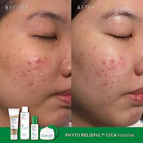THANKYOU FARMER Phyto Relieful CICA PHA LHA Boosting Toner 7.03 fl oz (200ml), Dermatologist Tested, Alcohol-Free Liquid Exfoliant for Face, Oil-Free Hydrating Toner, Vegan, Fragrance-Free