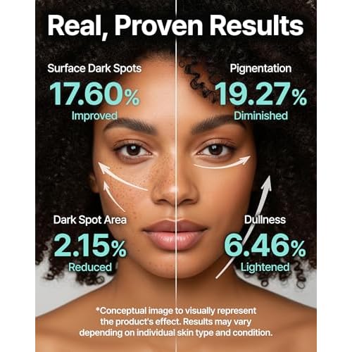 Charde Niacinamide 25% Snow Ampoule for Face, Dark Spot Care for Hyperpigmentation, Freckles & Sun Spots | Radiance Boosting with White Garcinia & Arbutin, Korean Skin Care, 1.01 fl. oz.
