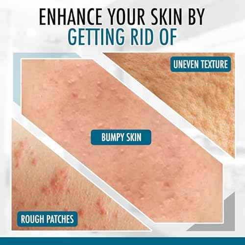 GLY MIRACLE Moisturizing Body Cream Lotion, 16 ounce - Non-Greasy Skin Humectant for Extremely Dry Skin, Hands, Body, and Feet, Light Fresh Scent with Pure Glycerin for Nourishing Hydration.