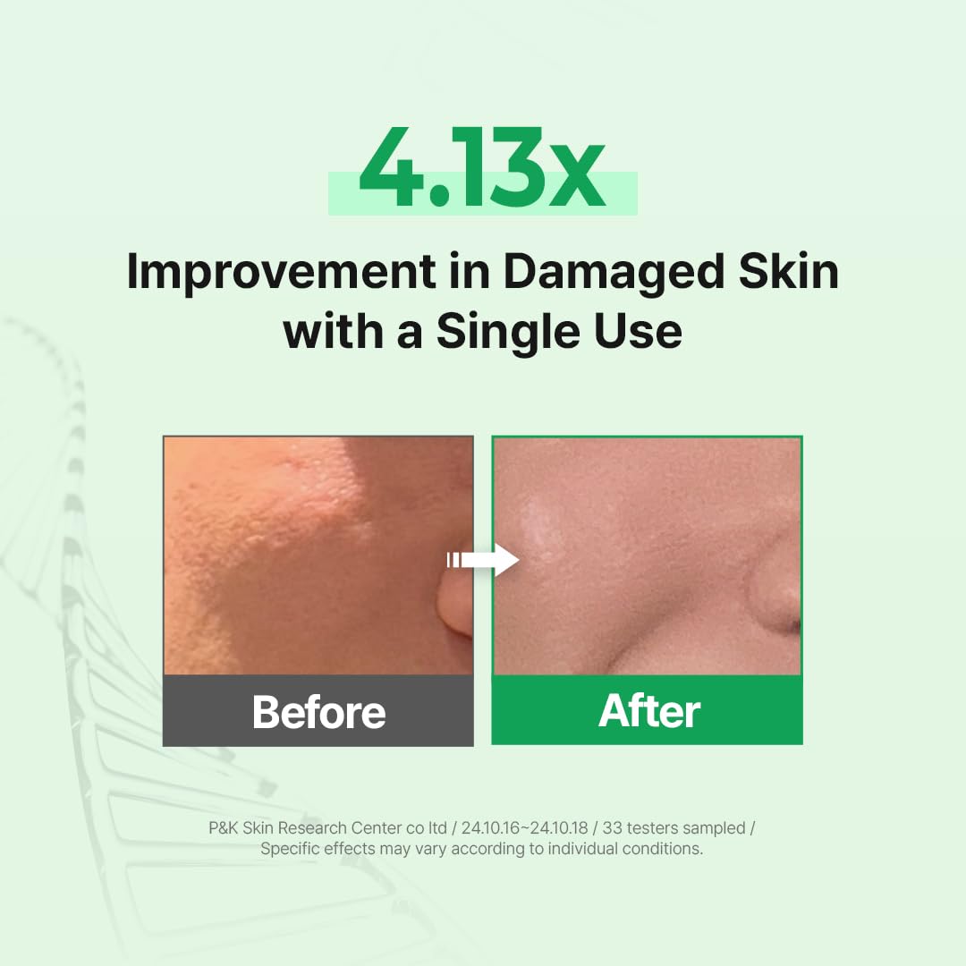 Zipiderm EGF Deep Cleansing Foam – Korean Gentle Facial Cleanser with EGF for Sensitive & Acne-Prone Skin, Double Cleansing K-Beauty Foam that Supports Skin Barrier & Smooth Texture, 4.05 fl oz