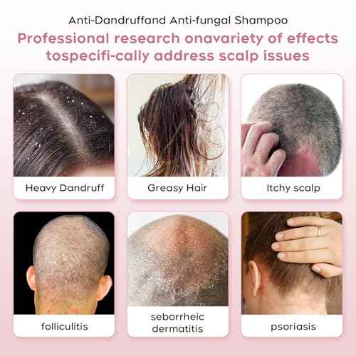 24HR Fast Itch Relief Anti-Fungal Shampoo for Psoriasis, Seborrheic Dermatitis & Folliculitis, Relieves Itchy, Dry Scalp, Sulfate & Paraben Free Anti-Dandruff Shampoo for Men and Women, 8.4 fl oz