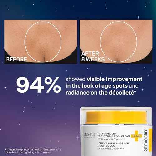 StriVectin TL Advanced¢â Holiday Duo Tighten and Sculpt Kit, Brighten and Lift Skin Tone, Peptides and Hyaluronic Acid