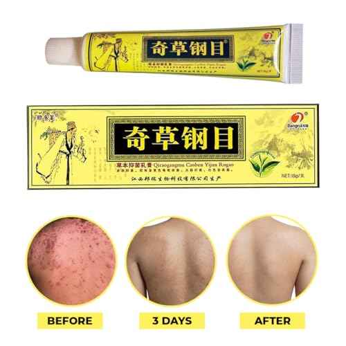 Official Seller - Chinese Herbal Cream - Natural Relief for Skin Issues - Pack of 5